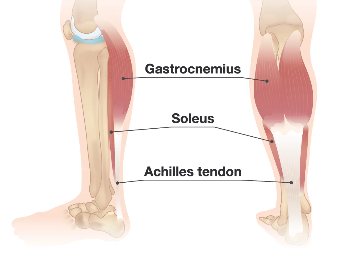 The back of a lower leg showing the larger gastrocnemius muscle near the knee, the flatter soleus muscle below it, and both joining the Achilles tendon at the heel.