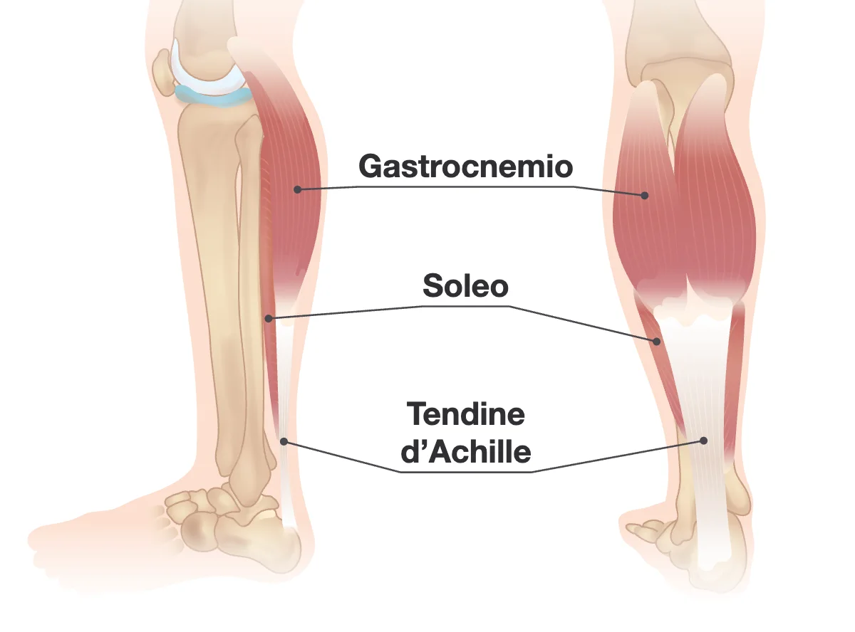 Viste laterale e posteriore di una gamba con i muscoli gastrocnemio e soleo che si assottigliano nel tendine d’Achille, sopra il tallone.
