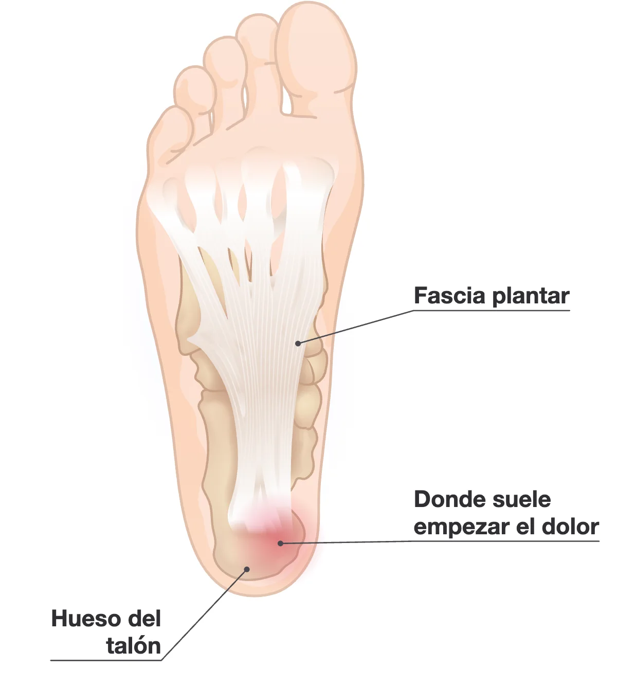 La planta de un pie con la fascia plantar resaltada del talón a los dedos